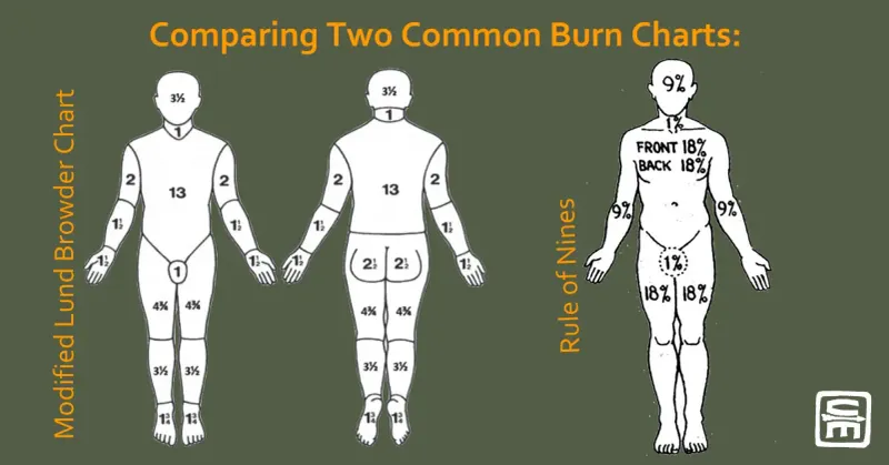 Rule of Nines vs Lund-Browder Burn Charts