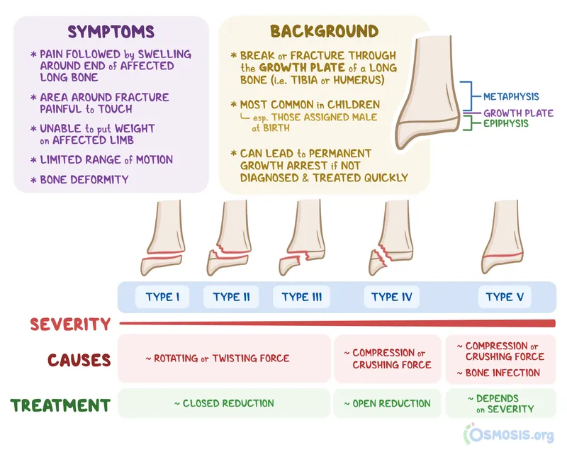 Salter-Harris Classification of Physeal Fractures