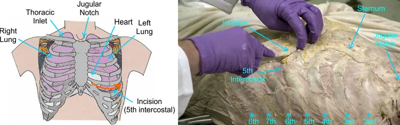 Anatomy for Resuscitative Thoracotomy