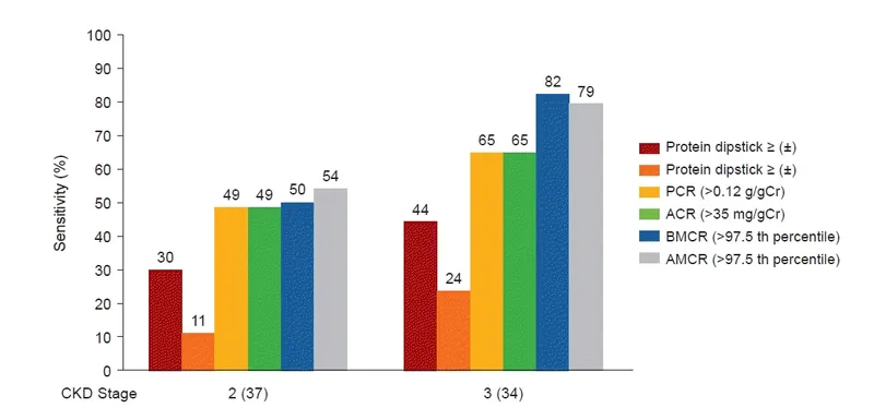 SFU Hydronephrosis Grading