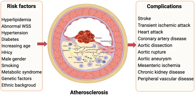 Atherosclerosis risk factors, progression, and complications