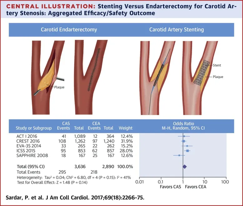 Carotid Endarterectomy vs. Carotid Artery Stenting