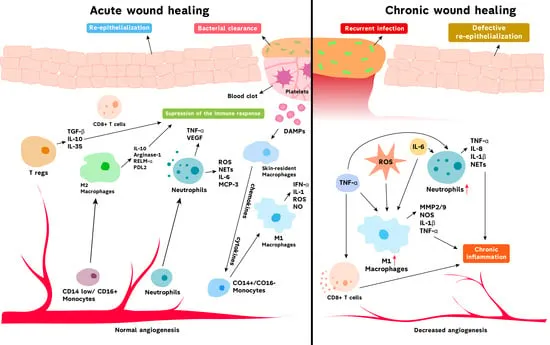 Acute vs. Chronic Wound Healing: Cellular & Molecular View