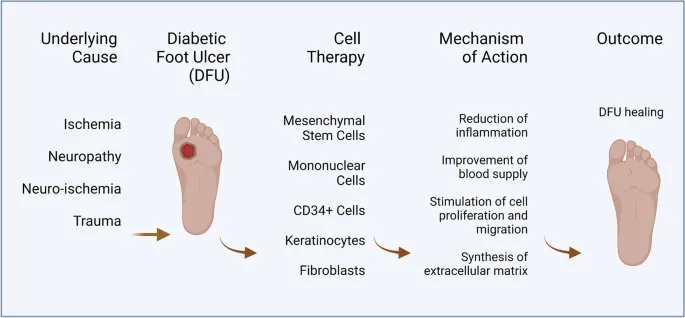 Diabetic Foot Ulcer: Causes, Cell Therapy, and Healing
