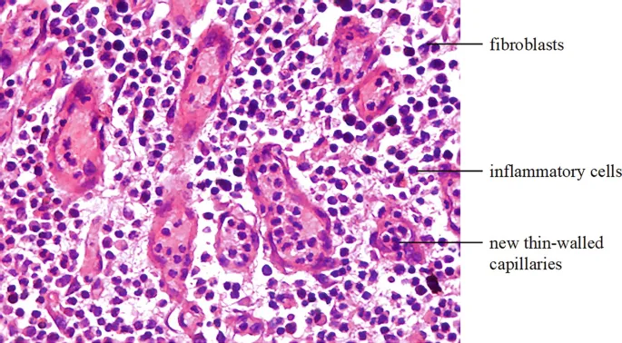 Histology of Granulation Tissue