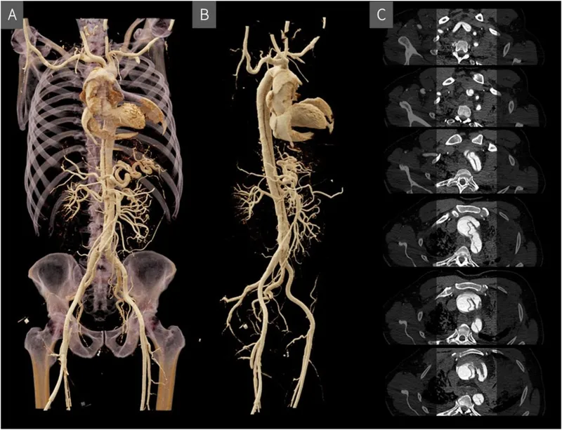 Virtopsy: 3D CT Angiography and Axial CT Slices