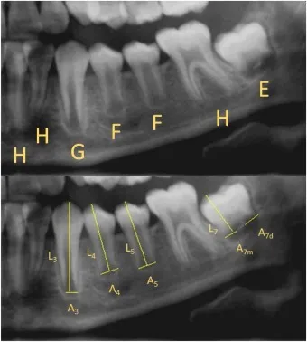 Dental age estimation using radiographic measurements