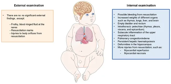 Infant Post-Mortem Examination Findings