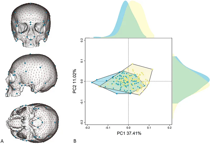 3D Skull Morphometric Analysis for Sex Determination