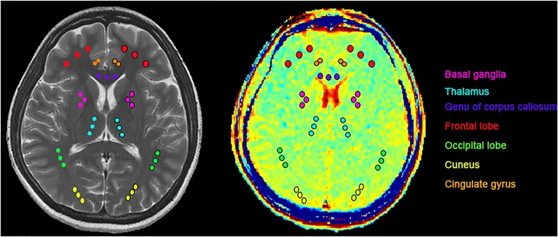 Brain MRI with labeled regions for forensic analysis
