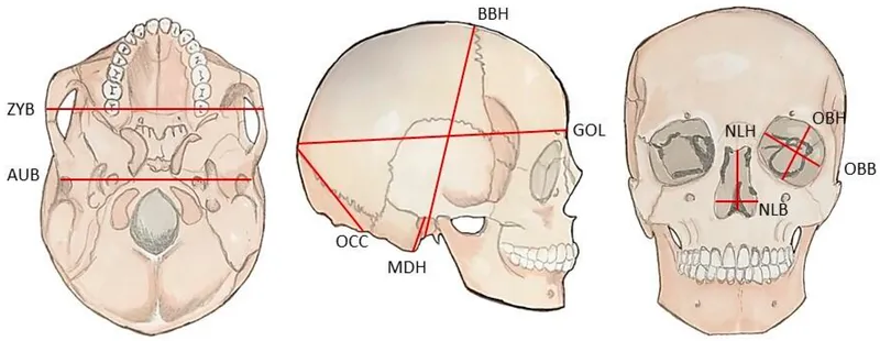 Skull measurements for forensic ancestry estimation
