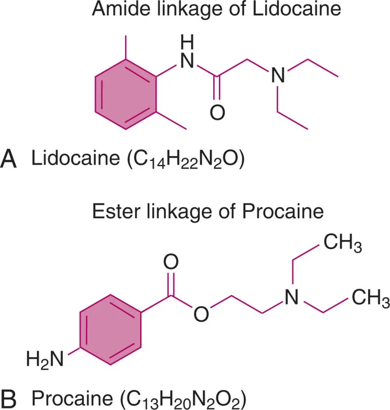 Lidocaine vs. Procaine: Amide and Ester Structures