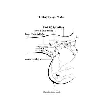Axillary Lymph Node Levels Diagram