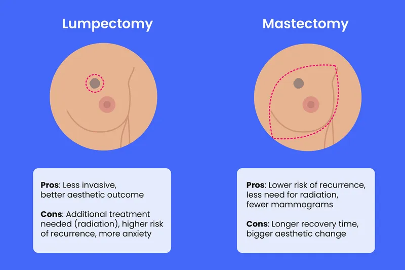 Lumpectomy vs. Mastectomy: Pros and Cons