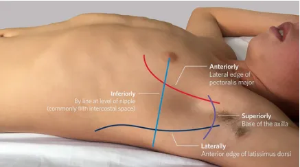 Triangle of Safety for Chest Tube Insertion