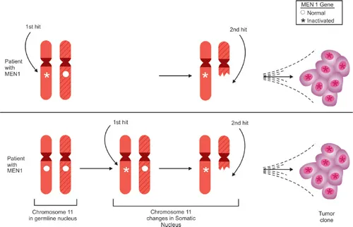 Knudson Two-Hit Hypothesis in MEN1 Syndrome