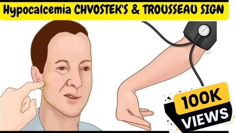 Chvostek's and Trousseau's signs in hypocalcemia
