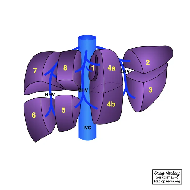 Couinaud segments of the liver with hepatic veins
