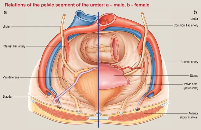 Pelvic ureter relations: male vs. female anatomy