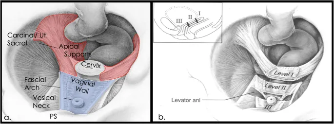 Female Pelvic Floor Anatomy with DeLancey's Levels