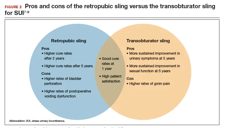 Retropubic vs. Transobturator Sling: Pros & Cons for SUI