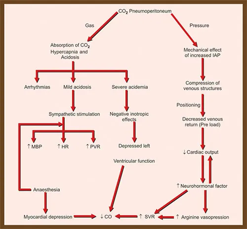 Physiological effects of pneumoperitoneum on body systems