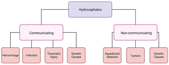 Hydrocephalus: Communicating vs. Non-communicating Causes