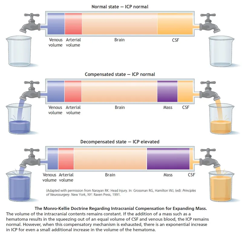 Monro-Kellie doctrine: ICP compensation for expanding mass