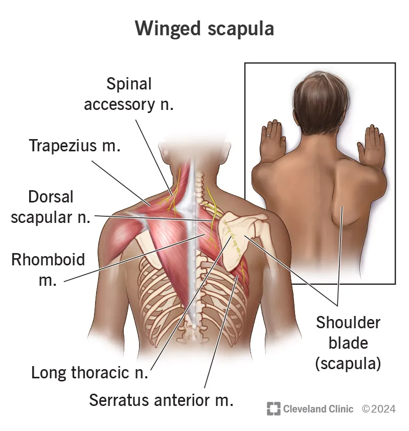 Winged Scapula: Anatomy and Physical Exam Finding
