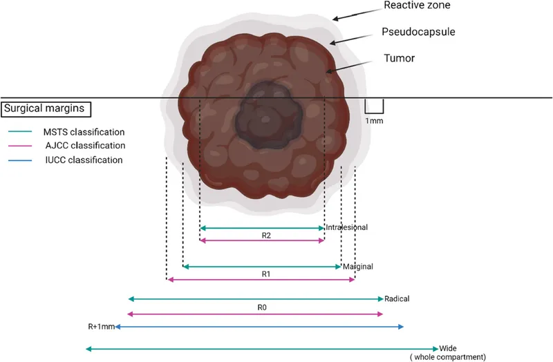 Surgical Resection Margins: R0, R1, R2 Classifications