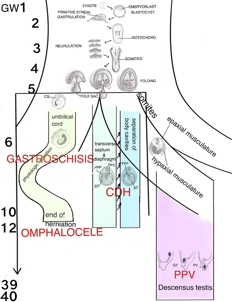 Embryology of Gastroschisis and Omphalocele