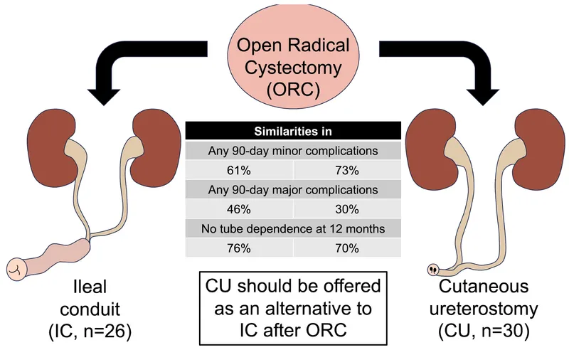 Ileal conduit vs. cutaneous ureterostomy after cystectomy