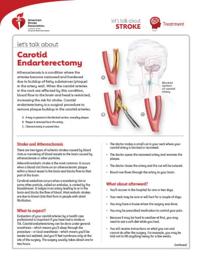 Carotid Endarterectomy: Plaque Removal & Blood Flow