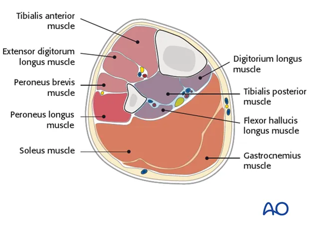 Lower Leg Compartments: Muscles & Neurovascular Bundles