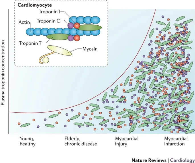 Laboratory technician analyzing cardiac troponin levels using high-sensitivity assay