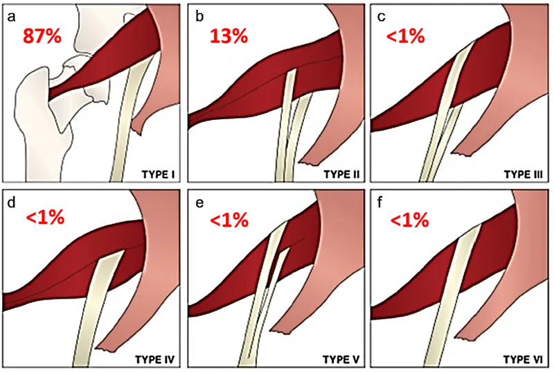 Surgical management approaches for anatomical variations