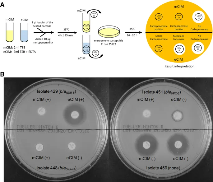Laboratory detection methods for carbapenemase-producing organisms