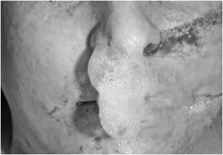 drowning foam airways