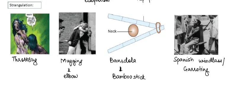 manual strangulation neck injuries