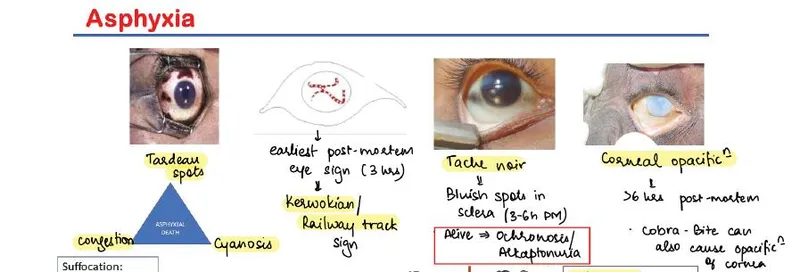 tardieu spots petechiae