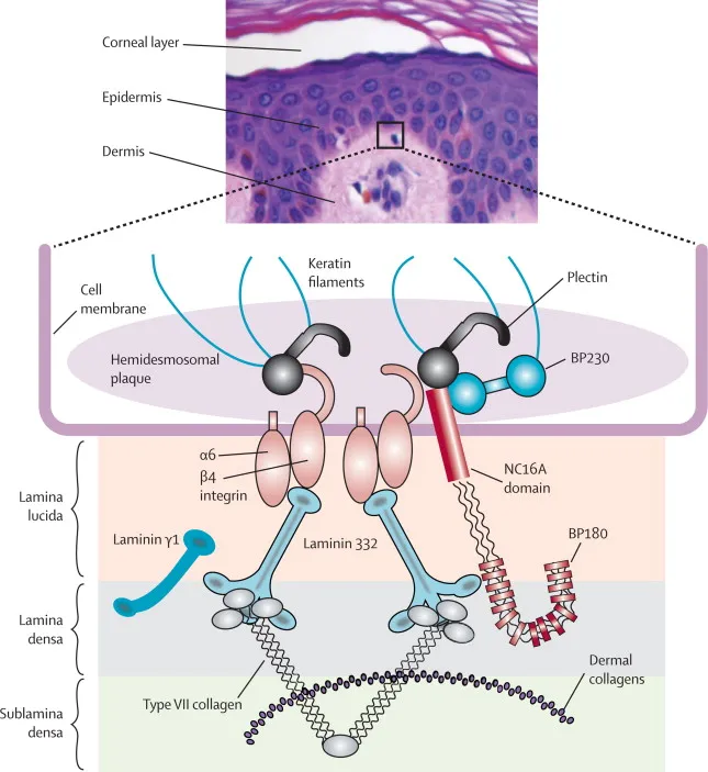 Autoimmune Skin Diseases NEET PG Lessons Oncourse