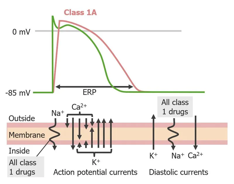 antiarrhythmic drug mechanisms