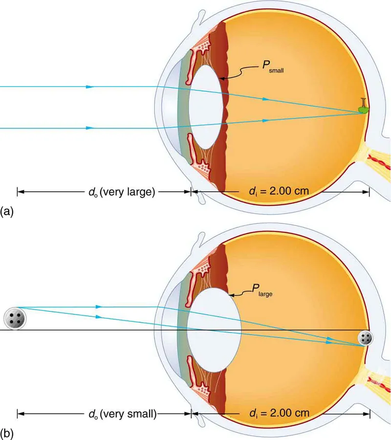 Diagram showing light refraction through cornea aqueous lens and vitreous