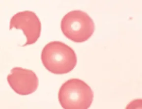 erythrocyte structure diagram