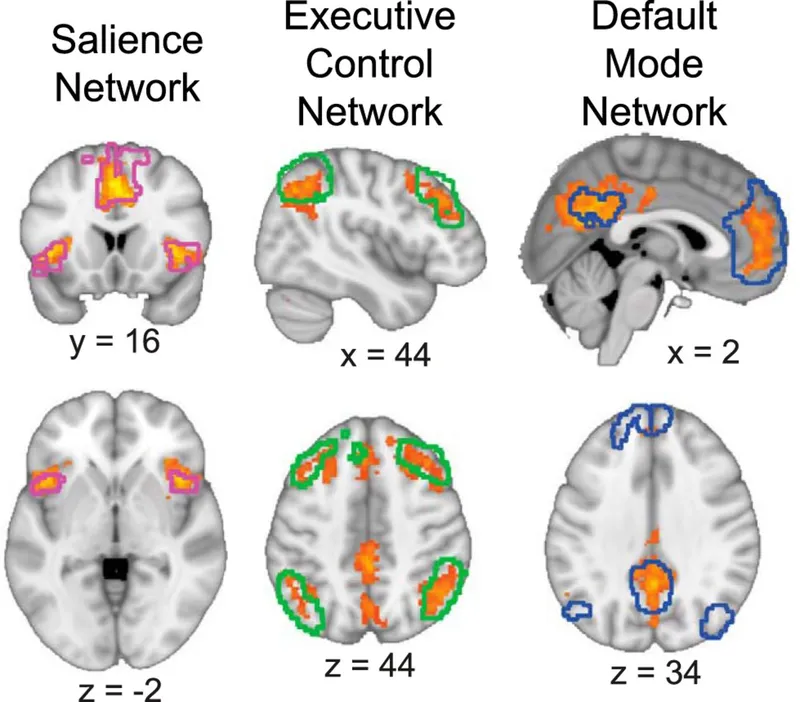 Brain connectivity networks showing default mode and executive control