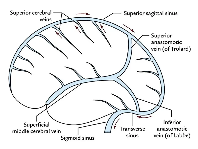 Cerebral venous anatomy showing major sinuses and drainage