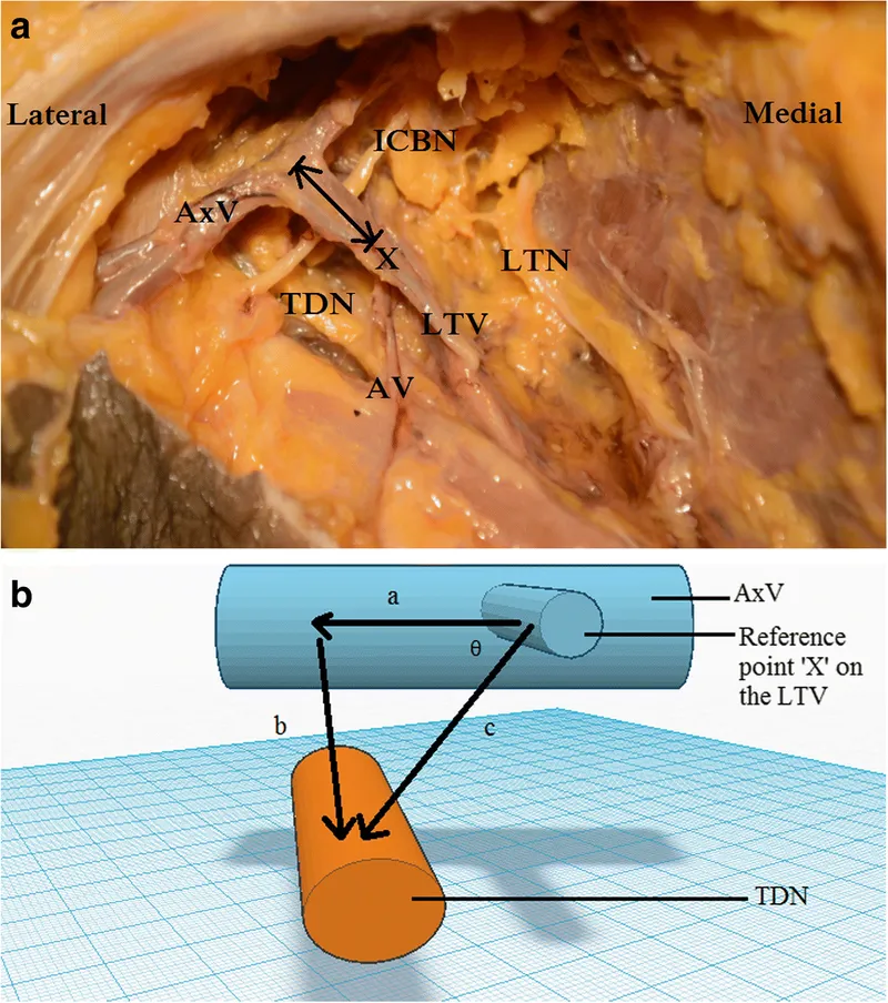 Surgical anatomy showing critical nerves during axillary dissection