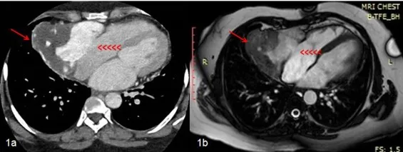 Cardiac CT structural evaluation applications