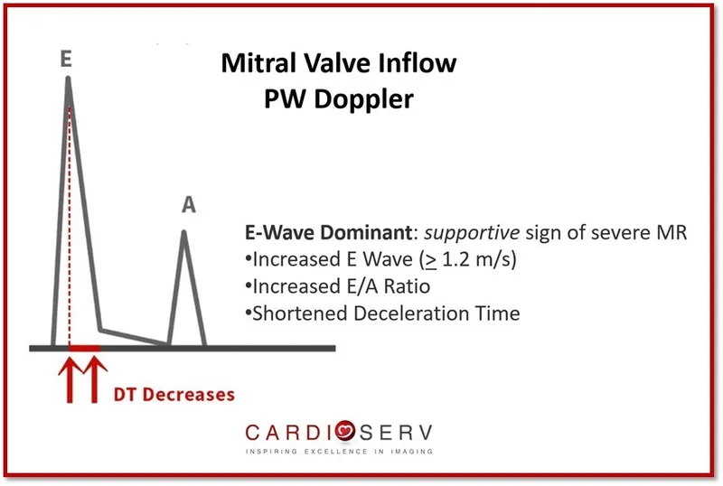 diastolic function echocardiography