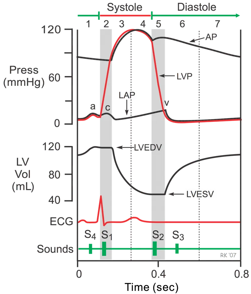 Hemodynamic pressure waveforms showing arterial and venous pressure curves